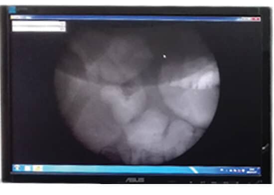 Xray Screen Image